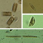 Kieselalgen (Diatomea, lichtmikroskopische Aufnahme)