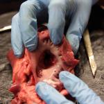 Blick in den Herzmuskel